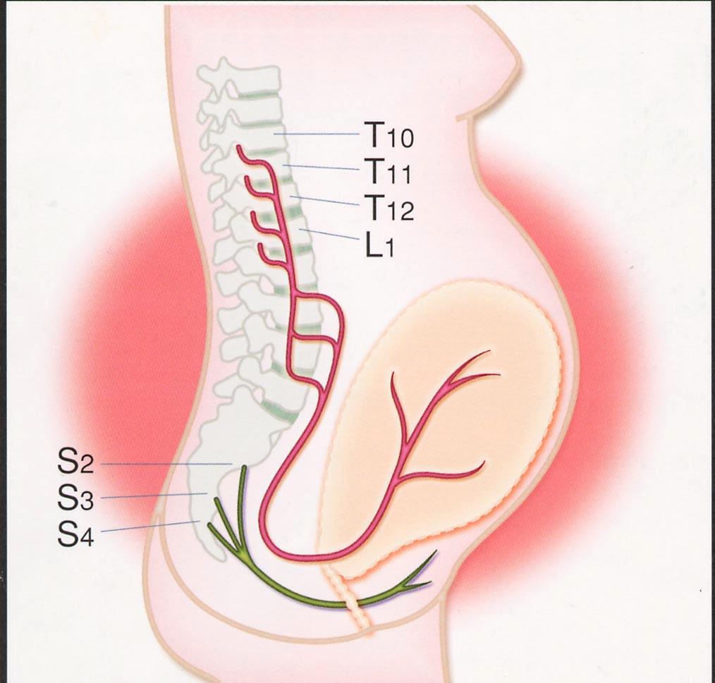分娩出産の痛みの経路 分娩第 Ⅰ 期子宮収縮