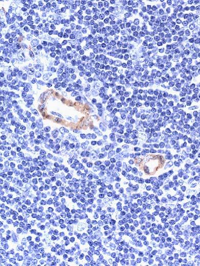 ヒストファインマウスステインキットによる内因性免疫グロブリンの阻止 ( 左 : ヒト組織用ヒストファインシンプルステイン MAX-PO(M), 右 : マウス組織用ヒストファインマウスステインキット ) ICR マウス脾臓におけるマウス抗アクチン ( 平滑筋 ) モノクローナル抗体染色. ヒト組織用標識二次抗体では, 血管平滑筋と形質細胞 ( 矢印 ) に強陽性を示す ( 写真左 ).