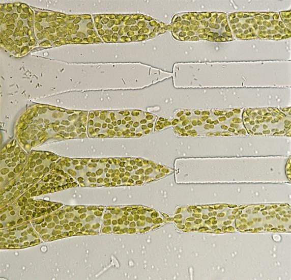 スケールは50マイクロメートル ヒメツリガネゴケ ( 学名 :Physcomitrella patens) の原糸体細胞にも同様の試験を行った結果