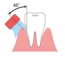 歯周病に特化した最新の歯みがき法 歯ブラシは柔らかめを えんぴつ持ち歯 1