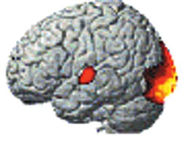 ところは 脳が働いている場所 脳の中で血 液の流れが速いところ で 赤から黄色にな