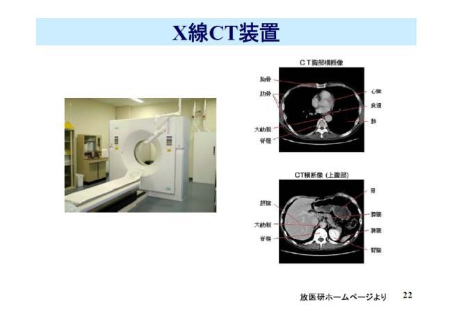 の一つであります これは皆さんご存じのようにX 線 CT で 聞いたことがあるという方もたくさんいると思います CT の開発者はノーベル賞をもらっております CT のノーベル賞をもらった方の論文を見てみると日本人の論文が引用されています 既に亡くなってしまいましたが