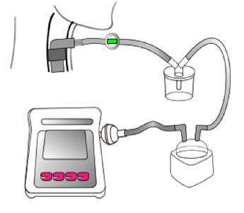 1. ハンドブックで使用する人工呼吸器と周辺機器等の名称 加温加湿器を使用する場合 気管切開チューブ ( 気管カニューレ ) 呼気弁 カフ ウォータートラップ