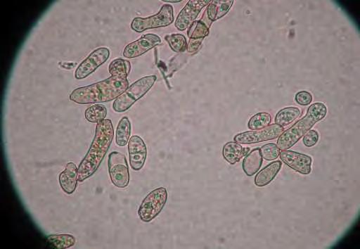 葉かび病菌胞子