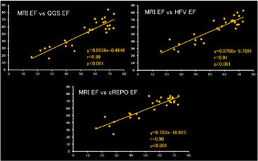 Fig.11 MRI vs ソフトウェアの比較 (EDV) Fig.12 MRI vs ソフトウェアの比較 (ESV) 結果 4 Fig.13 MRI vs ソフトウェアの比較 (EF) 99m Tc 心筋血流 SPECT と心臓 MRI から算出された EDV を比較したものを示す (Fig.