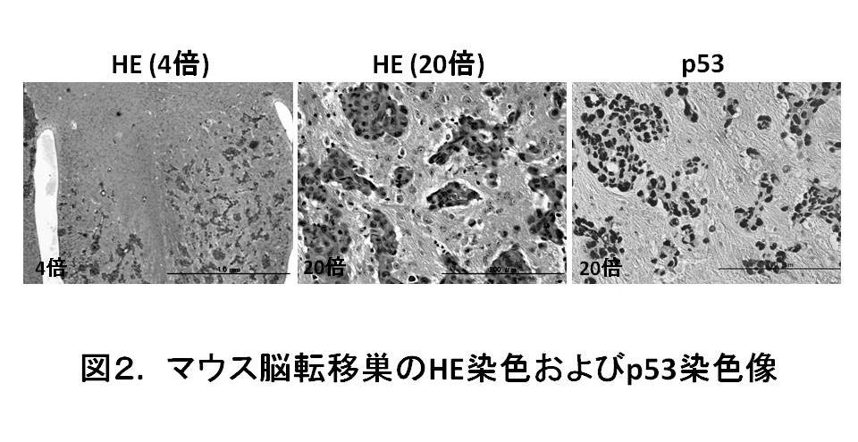 Goto, Tatsuyuki Chiyoda, Shinji Kuninaka, Tatsuhiro Shibata, Hirokazu Ohata, Hitoshi Nakagama, Yoichi Taya, Hideyuki Saya: Induction of ZEB Proteins by Inactivation of RB Protein Is Key Determinant