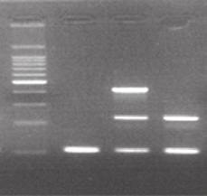 が 2 倍 4 倍 8 倍 と指数関数的に増幅し やがてプラトー ( 一時的に停滞する状態 ) に達します この方法を用いると 数時間で少なくとも 10 5 倍にDNAを増幅できます 反応終了後はアガロースゲル電気泳動に供し 増幅産物のバンドの有無を目視で判定します エンドポイント PCR の実験フロー 核酸抽出試薬の調製 PCR 反応電気泳動 約 30 分 ~ 約 10 分 ~ 約 2 時間