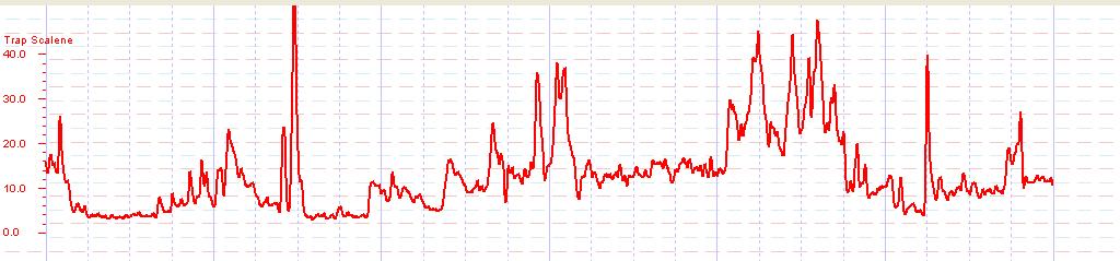 10 図 1.5. 記録した信号の平滑化 実際の患者の記録からとった平滑化の例を図 1.6.