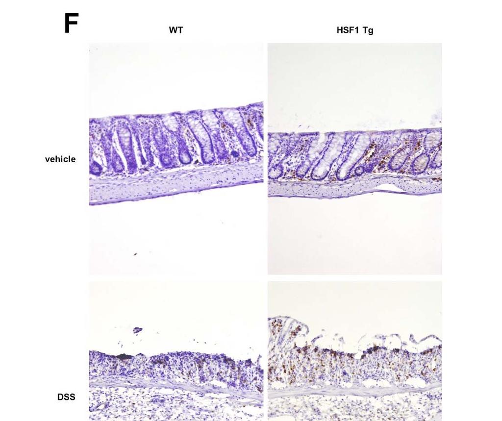 Fig.3. Development of DSS-induced colitis in transgenic mice expressing HSF1 and wild-type mice.