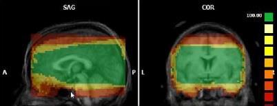 イメージデータフォーマット BrainVoyager は MRI スキャナーのすべてのベンダーの 及び DICOM や ANALYSE などの標準的フォーマットについての スライスベースの脳の構造的及び機能的 MRI データを組み合わせて