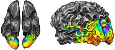 自動の大脳皮質の容量および皮質の厚さ分析も行えます また サーフェス上の小部分のどこにおいても
