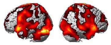 脳機能イメージング研究のレビュー 単純計算例