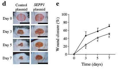過剰 SeP による血管新生の抑制 * SeP 増加マウスにおける損傷治癒の遅延