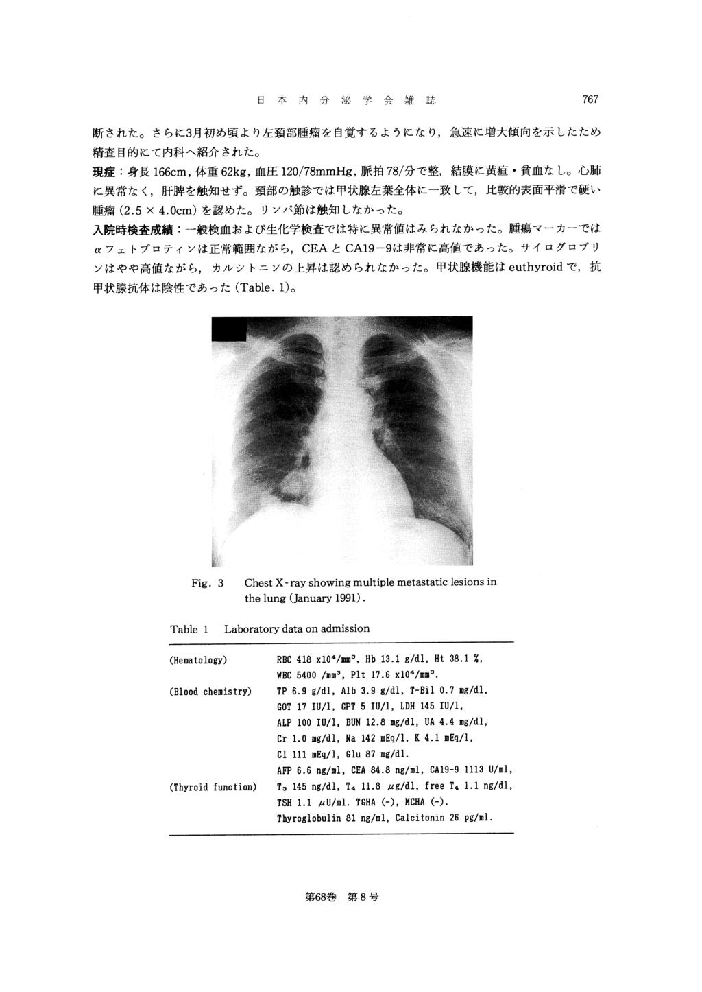 Fig. 3 Chest X-ray showing multiple metastatic lesions in