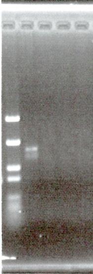 PCRのプライマー primer-f: agctcattactttatcagtgca!