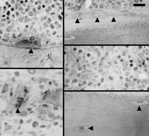 1 μm C: 骨芽細胞 ( 投与後 2 時間 ) A: 破骨細胞 ( 投与後 2 時間 ) D: 骨髄細胞 ( 投与後 2 時間 ) E: 骨細胞 ( 投与後 2 時間 ) B: 変性破骨細胞 ( 投与後 3 日 ) 図 2.6.