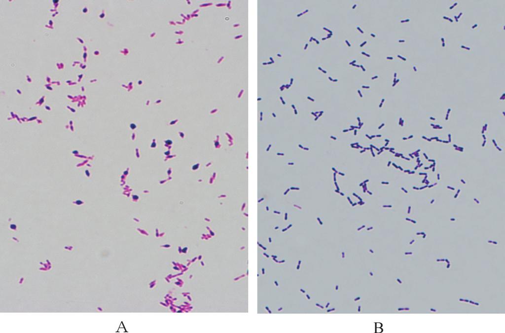 Solobacterium moorei 1 239 2 Solobacterium moorei Antimicrobial agent MIC (mg/ml) Ampicillin 0.06 Penicillin G 0.06 Piperacillin 0.5 Cefmetazole 0.5 Ceftizoxime 0.5 Cefozopran 0.5 Flomoxef 0.